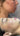 hyperpigmentation, pigmentation skin, cosmelan 2, pih skin, skin hyperpigmentation, postinflammatory hyperpigmentation, melanin pigmentation, hyperpigmentation spots, hyperpigmentation cause, what hyperpigmentation, PIE
