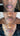 hyperpigmentation, pigmentation skin, cosmelan 2, pih skin, skin hyperpigmentation, postinflammatory hyperpigmentation, melanin pigmentation, hyperpigmentation spots, hyperpigmentation cause, what hyperpigmentation, melasma specialist, mesoestetic cosmelan, cosmelan peel, cosmelan 2, dermamelan, cosmelan peel near me, cosmelan 1, cosmelan treatment, mesoestetic, cosmelan, dermamelan treatment, mesoestetic, cosmelan 2, cosmelan before and after, pigmentation specialist