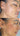 hyperpigmentation, pigmentation skin, cosmelan 2, pih skin, skin hyperpigmentation, postinflammatory hyperpigmentation, melanin pigmentation, hyperpigmentation spots, hyperpigmentation cause, what hyperpigmentation,enlighten peel reveskin enlighten peel before and after enlighten peel near me enlighten rx reveskin peel lereve skincare reve enlighten peel