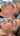 hyperpigmentation, pigmentation skin, cosmelan 2, pih skin, skin hyperpigmentation, postinflammatory hyperpigmentation, melanin pigmentation, hyperpigmentation spots, hyperpigmentation cause, what hyperpigmentation, melasma specialist, mesoestetic cosmelan, cosmelan peel, cosmelan 2, dermamelan, cosmelan peel near me, cosmelan 1, cosmelan treatment, mesoestetic, cosmelan, dermamelan treatment, mesoestetic, cosmelan 2, cosmelan before and after, pigmentation specialist