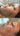 hyperpigmentation, pigmentation skin, cosmelan 2, pih skin, skin hyperpigmentation, postinflammatory hyperpigmentation, melanin pigmentation, hyperpigmentation spots, hyperpigmentation cause, what hyperpigmentation, melasma specialist, mesoestetic cosmelan, cosmelan peel, cosmelan 2, dermamelan, cosmelan peel near me, cosmelan 1, cosmelan treatment, mesoestetic, cosmelan, dermamelan treatment, mesoestetic, cosmelan 2, cosmelan before and after, pigmentation specialist
