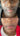 hyperpigmentation, pigmentation skin, cosmelan 2, pih skin, skin hyperpigmentation, postinflammatory hyperpigmentation, melanin pigmentation, hyperpigmentation spots, hyperpigmentation cause, what hyperpigmentation, enlighten peel reveskin enlighten peel before and after enlighten peel near me enlighten rx reveskin peel lereve skincare reve enlighten peel