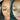 hyperpigmentation, pigmentation skin, cosmelan 2, pih skin, skin hyperpigmentation, postinflammatory hyperpigmentation, melanin pigmentation, hyperpigmentation spots, hyperpigmentation cause, what hyperpigmentation