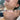 nodular acne, facial scars, acne before and afters, ice pick scars, pimple scars, facials for acne near me, acne extraction, benzoyl peroxide before and after
