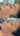 nodular acne, facial scars, acne before and afters, ice pick scars, pimple scars, facials for acne near me, acne extraction, benzoyl peroxide before and after