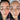hyperpigmentation, pigmentation skin, cosmelan 2, pih skin, skin hyperpigmentation, postinflammatory hyperpigmentation, melanin pigmentation, hyperpigmentation spots, hyperpigmentation cause, what hyperpigmentation, melasma specialist, mesoestetic cosmelan, cosmelan peel, cosmelan 2, dermamelan, cosmelan peel near me, cosmelan 1, cosmelan treatment, mesoestetic, cosmelan, dermamelan treatment, mesoestetic, cosmelan 2, cosmelan before and after, pigmentation specialist