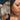 hyperpigmentation, pigmentation skin, cosmelan 2, pih skin, skin hyperpigmentation, postinflammatory hyperpigmentation, melanin pigmentation, hyperpigmentation spots, hyperpigmentation cause, what hyperpigmentation