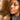 nodular acne, facial scars, acne before and afters, ice pick scars, pimple scars, facials for acne near me, acne extraction, benzoyl peroxide before and after