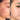 nodular acne, facial scars, acne before and afters, ice pick scars, pimple scars, facials for acne near me, acne extraction, benzoyl peroxide before and after